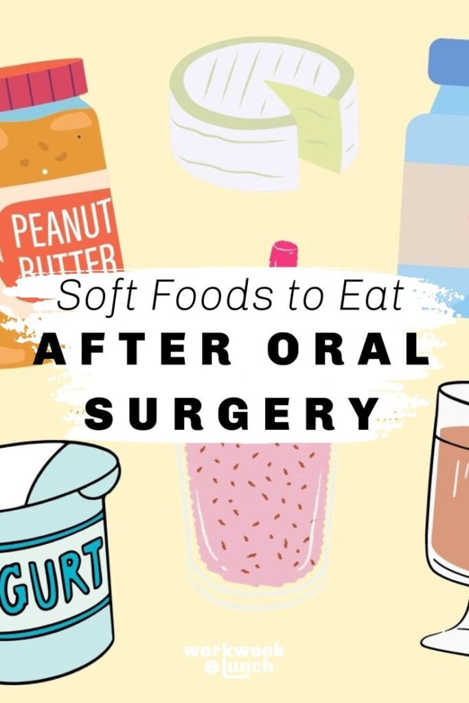 50 soft foods to eat after tooth extraction
